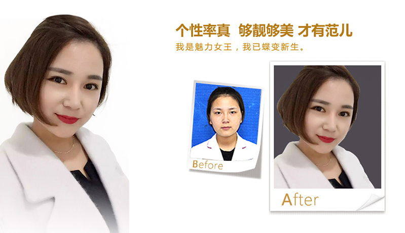 温州美鼻、V脸